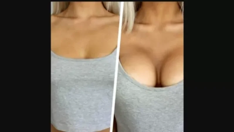 Երևանում ՌԴ քաղաքացին դիմել է ոստիկանություն. սխալ վիրահատության հետևանքով իր քիթը մեծացել է, կրծքերը՝ փոքրացել. Shamshyan .com