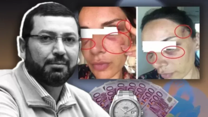 Կինը պնդում է` ՔՊ պատգամավոր Բաքոյանն իրեն ծեծի է ենթարկել