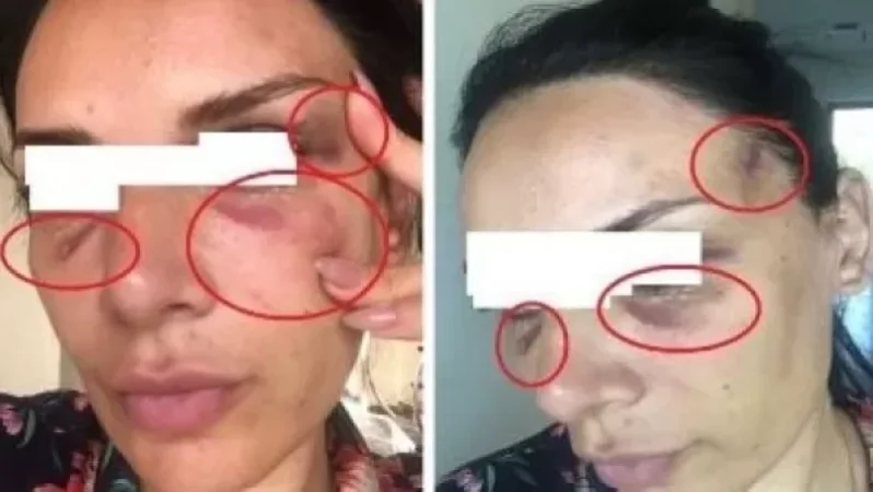 «Ինձ ասել է՝ ինչ ուզում ես հրապարակիր, մեր դեմ խաղ չկա». պատգամավորի նախկին կինը նոր մանրամասներ է հայտնել. News