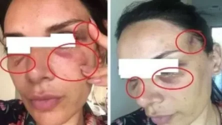 «Ինձ ասել է՝ ինչ ուզում ես հրապարակիր, մեր դեմ խաղ չկա». պատգամավորի նախկին կինը նոր մանրամասներ է հայտնել. News