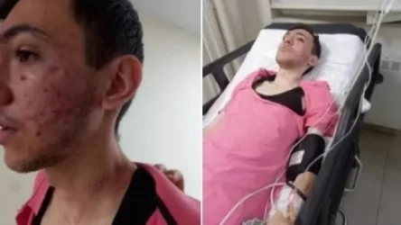 Լուսանկարներ․ Կարո Փայլանն ահազանգում է՝ Թուրքիայում հայազգի երիտասարդի վրա են հարձակվել