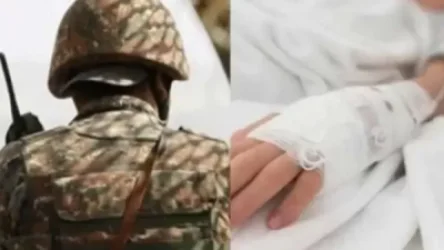 Ինչ վիճակում է այրվածքներ ստացած զինծառայողը․ ՊՆ խոսնակը մանրամասնում է