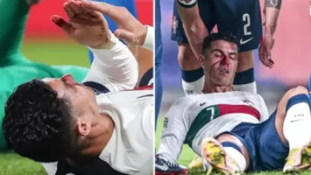 ՏԵՍԱՆՅՈՒԹ. Ռոնալդուի քիթը կոտրվել է խաղի ժամանակ