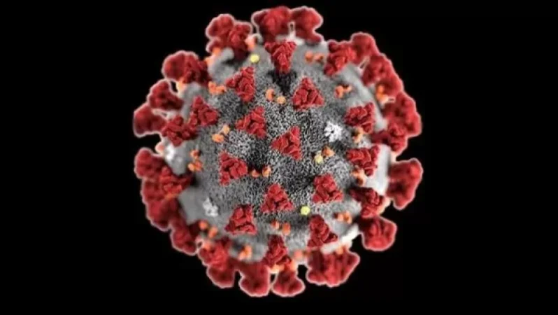 Հայաստանում Covid-19-ից ևս 5 մարդ է մահացել.ամենաերիտասարդը 63 տարեկան կին է