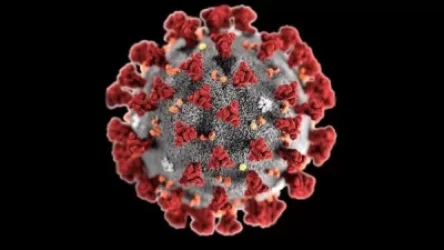 Հայաստանում Covid-19-ից ևս 5 մարդ է մահացել.ամենաերիտասարդը 63 տարեկան կին է