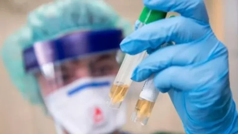 Կորոնավիրուսի վարակման 288 նոր դեպք, առողջացել է 478 մարդ