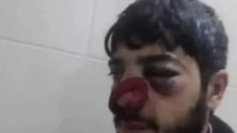 Ադրբեջանում դաժան ծեծի են ենթարկել ծառերի հատման դեմ անտառապահին