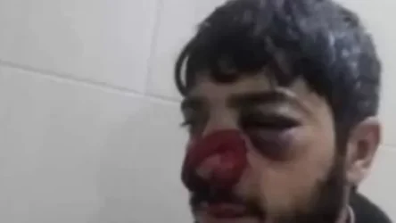 Ադրբեջանում դաժան ծեծի են ենթարկել ծառերի հատման դեմ անտառապահին