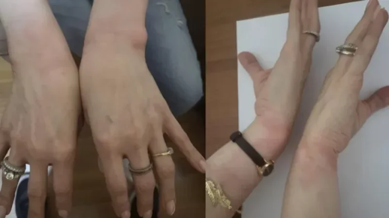 «Պարեկները բիրտ ուժ են կիրառել ՌԴ քաղաքացու նկատմամբ». փաստաբան