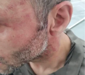 ՆԳՆ-ն` ոստիկանների կողմից քաղաքացուն բռնnւթյան ենթարկելու դեպքի մասին