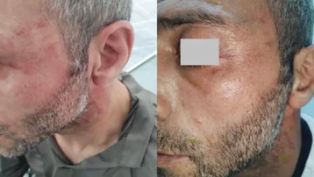 Կադրեր՝ ոստիկանները դաժան ծեծի են ենթարկել տղամարդուն․ փաստաբանը ահազանգում է