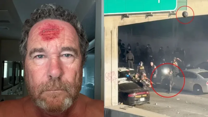 Լոս Անջելեսում ոստիկանը կրակել է լուսանկարչի գլխին