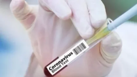 Արցախում կորոնավիրուսային հիվանդության նոր դեպք չի գրանցվել