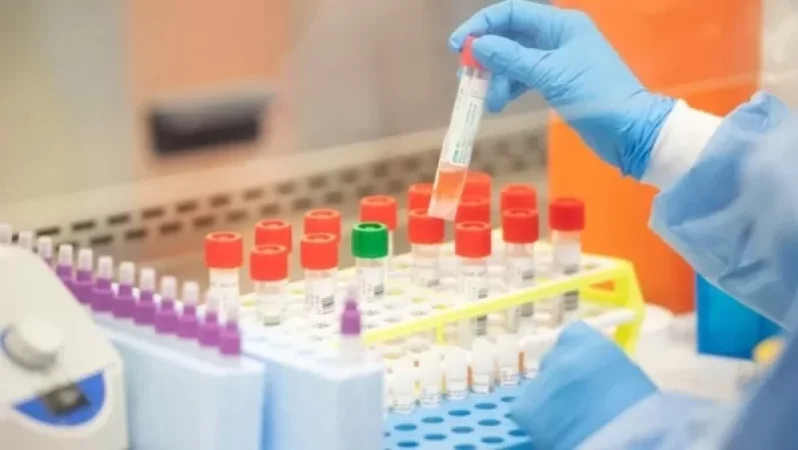 Արցախում կորոնավիրուսային հիվանդության 36 նոր դեպք է գրանցվել. 21 հիվանդի վիճակը ծայրահեղ ծանր է