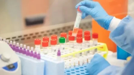 Արցախում կորոնավիրուսային հիվանդության 36 նոր դեպք է գրանցվել. 21 հիվանդի վիճակը ծայրահեղ ծանր է