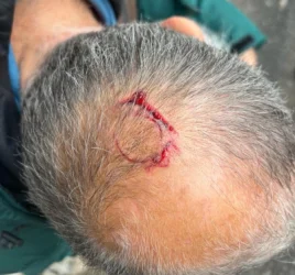 Հայտնի է Պռոշյան փողոցում ԱՄՆ քաղաքացու նկատմամբ ավազակային հարձակում կատարած անձի ինքնությունը