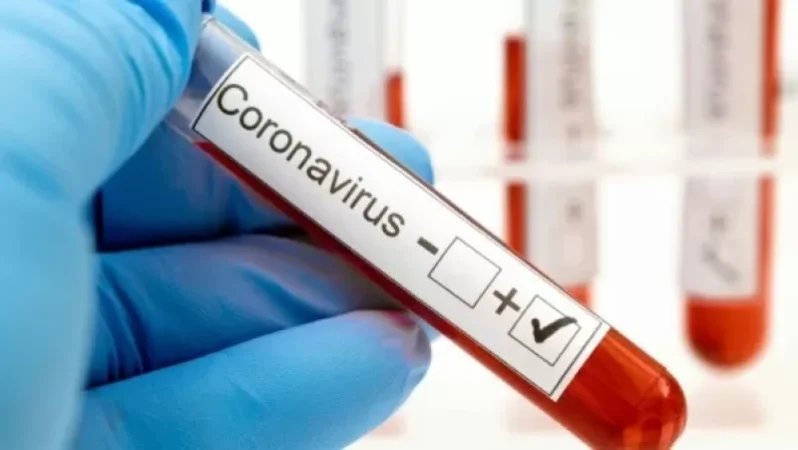 Կորոնավիրուսային հիվանդության ընթացքը Հայաստանում. ԱՆ հրապարակել է նոր տվյալները