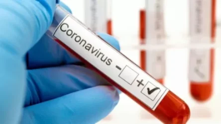 Կորոնավիրուսային հիվանդության ընթացքը Հայաստանում. ԱՆ հրապարակել է նոր տվյալները