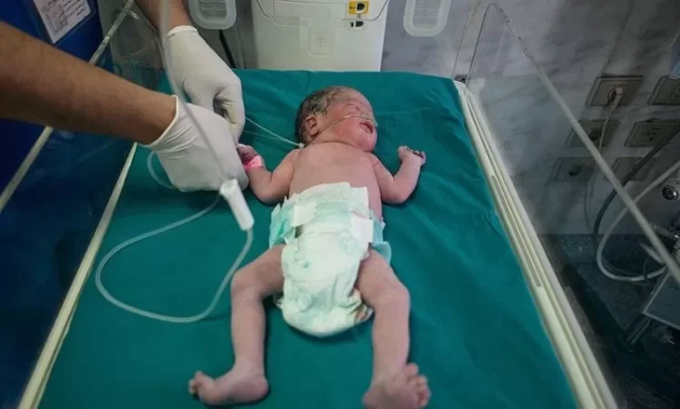 Իրաքում լույս աշխարհ եկած յոթնյակը մահացել է