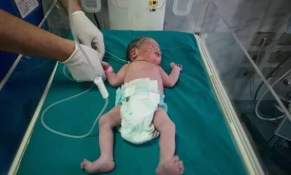 Իրաքում լույս աշխարհ եկած յոթնյակը մահացել է