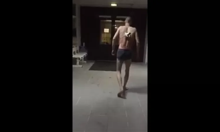 18+ VIDEO: Patient in Russia Goes Outside to Smoke with Surgical Knife in Back