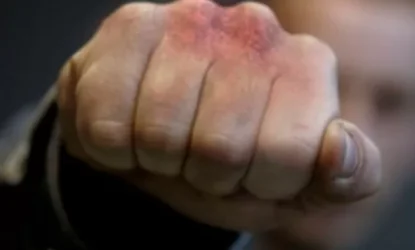 Ֆաբրիկայի ղեկավարն ու ինժեները ծեծի են ենթարկել աշխատակցին. Արտակարգ դեպք Սյունիքում