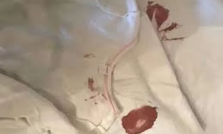 Երեքուկես տարեկան երեխային մանկապարտեզից տուն են տարել արյունոտ հագուստով