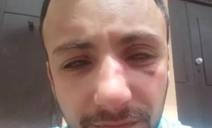 Վարդան Հարությունյանի հետ կապված միջադեպի մասնակիցներից մեկը բերման է ենթարկվել