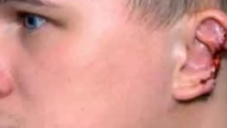 Վիճաբանության ժամանակ կծել են 29-ամյա երիտասարդի ականջը. Գ․ Շամշյան