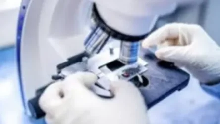 Հիվանդներից 3-ի մոտ ևս հաստատվել է սիբիրյան խոց