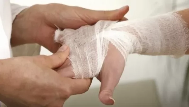 Այգեստանում բջջային հեռախոսը լիցքավորելու ժամանակ կարճ միացումից հրդեհ է բռնկվել. 12-ամյա աղջիկը այրվածքներ է ստացել