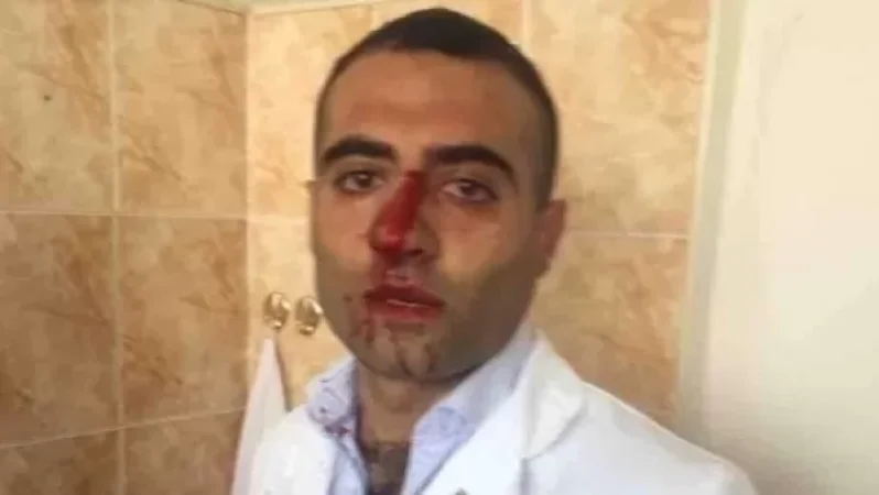 «Ժողովուրդ». ինչու է ուռուցքաբանության կենտրոնի տնօրենը կոտրել բժշկի քիթը. գումարը չե՞ն կարողացել կիսել