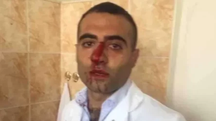 «Ժողովուրդ». ինչու է ուռուցքաբանության կենտրոնի տնօրենը կոտրել բժշկի քիթը. գումարը չե՞ն կարողացել կիսել