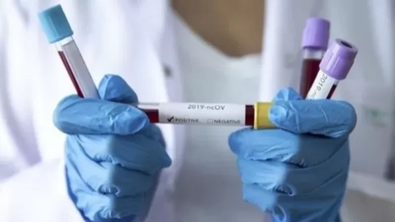 Բահրեյնում կորոնավիրուսի նոր դեպքեր են արձանագրվել