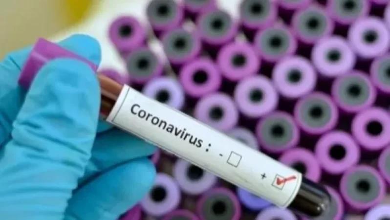 Ինչ անել, եթե վերադարձել եք այնպիսի երկրից, որտեղ գրանցվում են կորոնավիրուսի դեպքեր