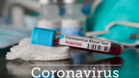 Կորոնավիրուսի տարածումը կանխելու նպատակով քրեակատարողական հիմնարկներում աշխատանքներ են կատարվում