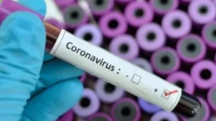 Արցախում կորոնավիրուսի կասկածով 13 քաղաքացիներից 12-ի արդյունքները բացասական են, 1-ի պատասխանը պարզ կլինի վաղը