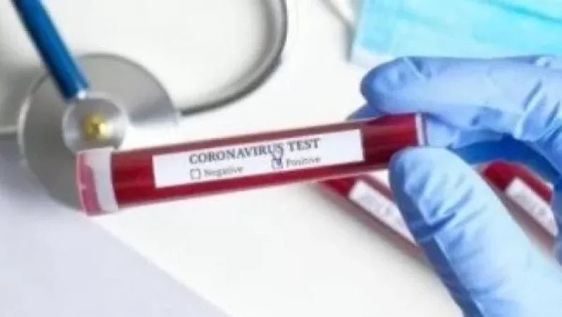 Փաշինյանը վստահեցնում է` կորոնավիրուսի մասին ողջ ինֆորմացիան հրապարակվում է թափանցիկ