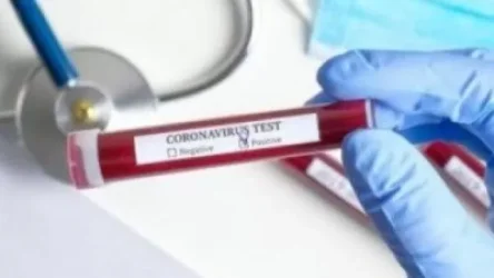 Փաշինյանը վստահեցնում է` կորոնավիրուսի մասին ողջ ինֆորմացիան հրապարակվում է թափանցիկ