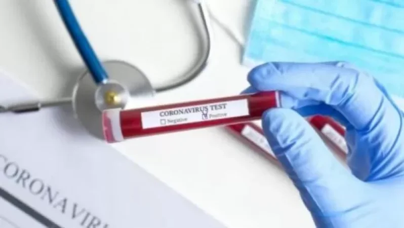 Հայաստանում կորոնավիրուսով վարակվածների ընդհանուր թիվը 235 է