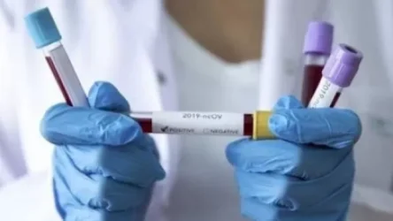 Վաղը հայտնի կդառնա զինծառայողներից վերցված նմուշառումների պատասխանները