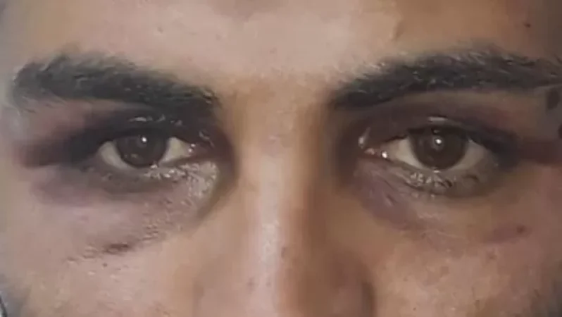 ՀՀ քաղաքացու՝ ոստիկանների կողմից բռնության ենթարկվելու մասին հաղորդման հիման վրա քրգործ է հարուցվել