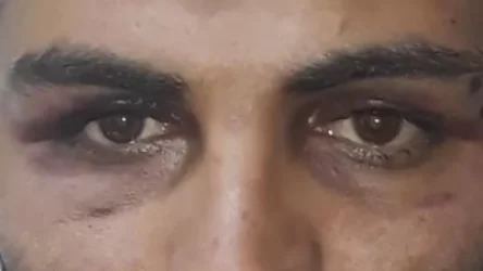 ՀՀ քաղաքացու՝ ոստիկանների կողմից բռնության ենթարկվելու մասին հաղորդման հիման վրա քրգործ է հարուցվել