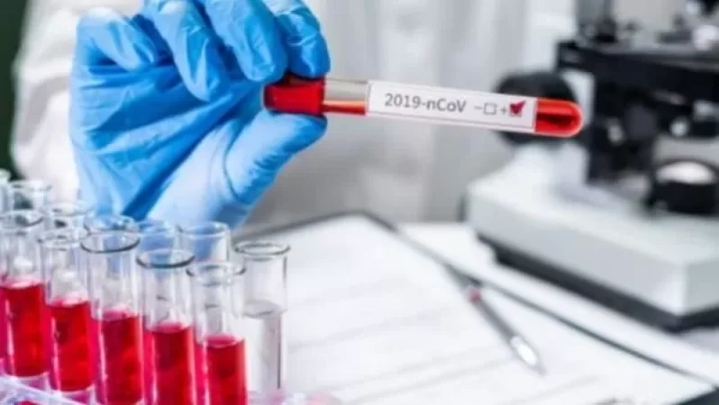 Կորոնավիրուս է ախտորոշվել ՄԱԿ-ի 9 աշխատակցի մոտ