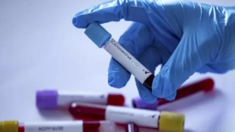 Կորոնավիրուսով պայմանավորված իրավիճակը Հայաստանի հարևան երկրներում․ Worldometers