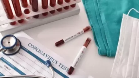 COVID-19. Աշխարհում ապաքինվել է գրեթե 230 հազար մարդ. մահացածների թիվն անցել 59 հազարից. Արմենպրես