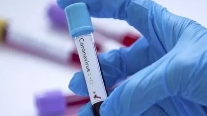 Հայտնի է, թե ովքեր են թեստավորվելու. Դրանց թվում են թոքաբորբ ունեցողները, բուժաշխատողները․ նախարար