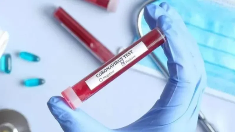 Ախուրյանի ԲԿ փոխտնօրենը թեստավորվել է. ԲԿ տնօրեն