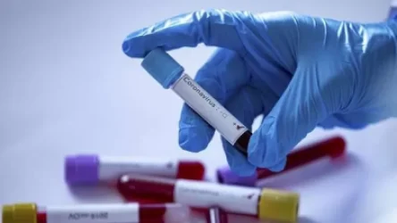 Ֆրանսիական հիվանդանոցներից մեկում կորոնավիրուսով հիվանդ եղել է դեռ դեկտեմբեր ամսին. The Guardian