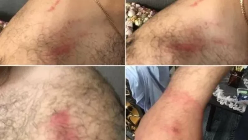 Բռնություն ոստիկանության Կապանի բաժնում. Ոստիկանապետ Արման Սարգսյանի հանձնարարությամբ կատարվում է ծառայողական քննություն